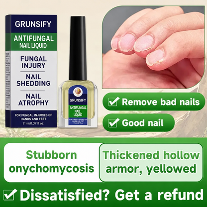 ✨Potent Natural Toenail Fungus Treatment Spray | Fights Foot Fungus, Provides Fast Itch Relief